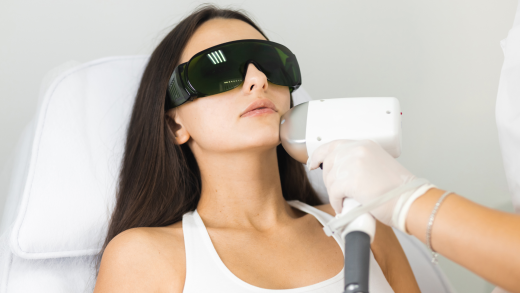 Descubra se quem usa protetor solar clareador pode fazer depilação a laser no rosto