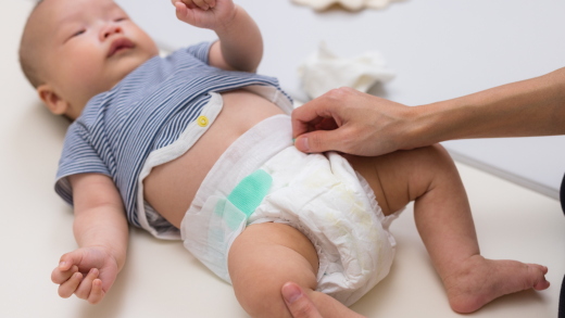 Como escolher o tamanho de fralda ideal entre fralda M, G e XG conforme o peso do bebê e saiba qual fralda comprar em cada fase